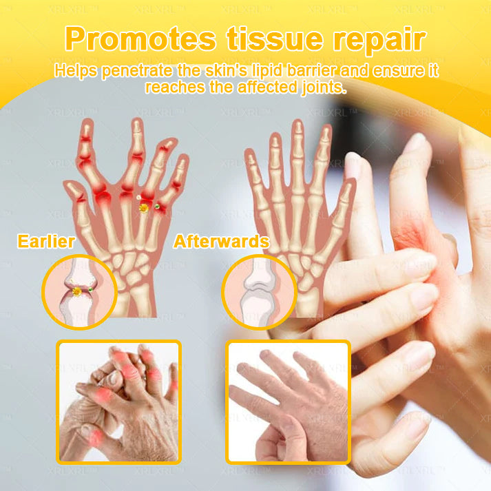 XRLXRL® Bee Venom Pain-Relief Bone Healing Cream 🎉🎉(Specially for older adults)