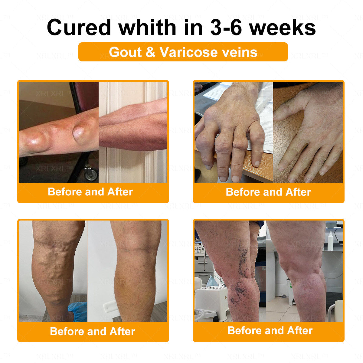 XRLXRL® Bee Venom Pain-Relief Bone Healing Cream 🎉🎉(Specially for older adults)