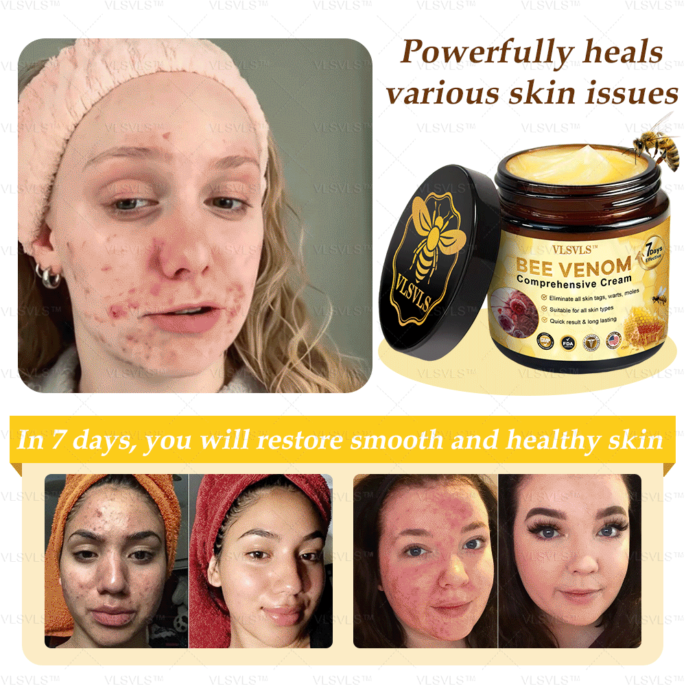 VLSVLS™ Bee Venom Comprehensive Cream 🔥🔥(Suitable for all ages & AAD recommends)