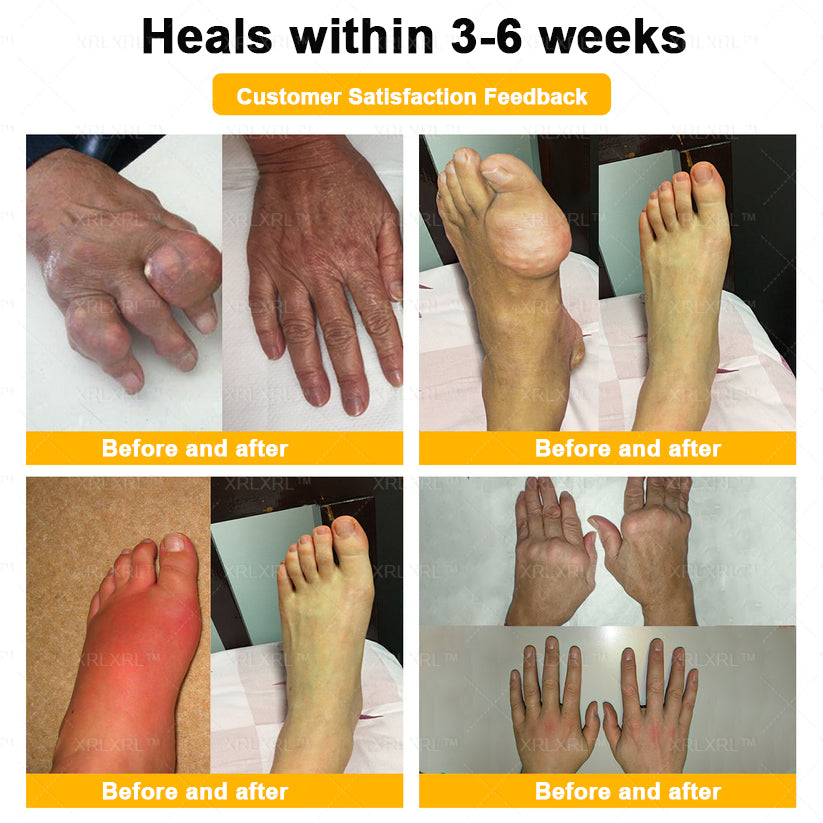 XRLXRL® Bee Venom Pain-Relief Bone Healing Cream 🎉🎉(Specially for older adults)