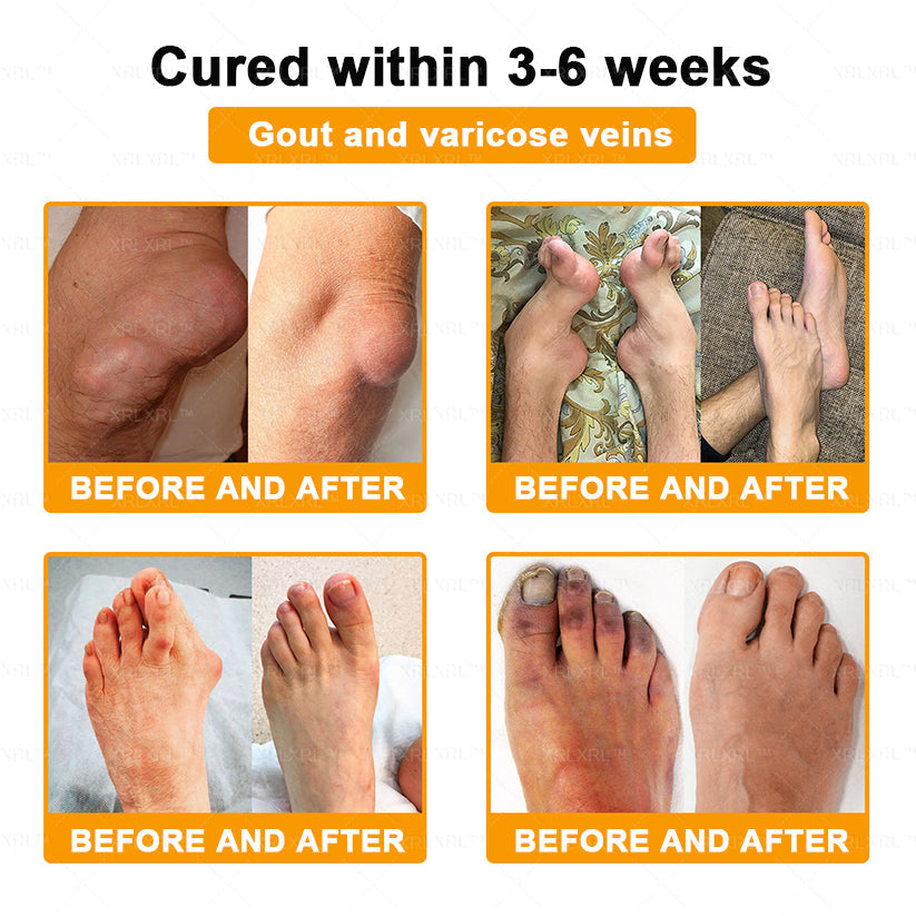 XRLXRL® Bee Venom Pain-Relief Bone Healing Cream 🎉🎉(Specially for older adults)