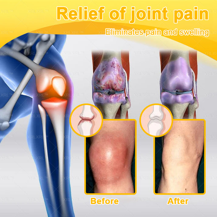 XRLXRL® Bee Venom Pain-Relief Bone Healing Cream 🎉🎉(Specially for older adults)